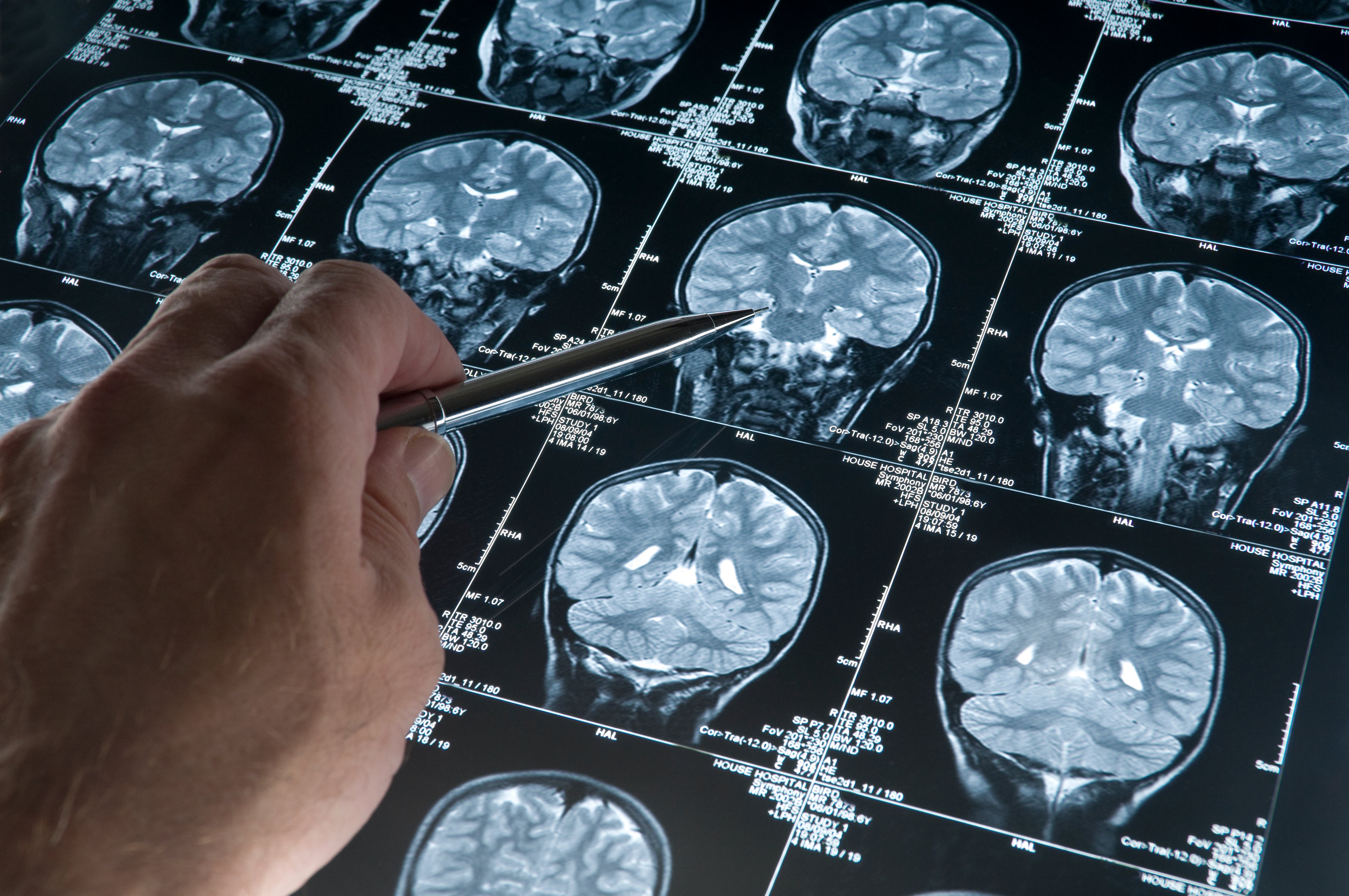 Professor of Clinical Neuropsychology Barbara Sahakian described reading as ‘exercise for the brain’